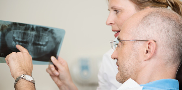 Zahnimplantate futsch: Experten warnen vor zu früher Belastung