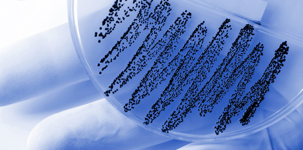 Parodontitis-Bakterien mögliche Darmkrebsauslöser