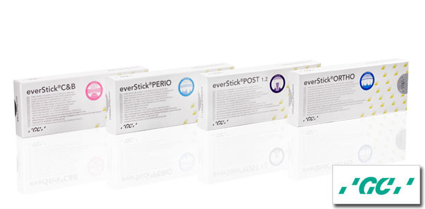 GC everStick: Patentierte Glasfaserverstärkungen für die tägliche Zahnheilkunde