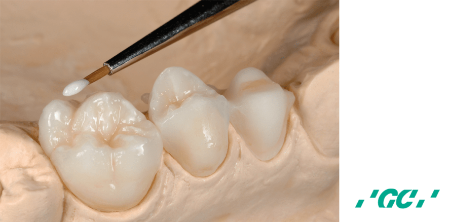 GC Initial LiSi: Ästhetik der nächsten Dimension