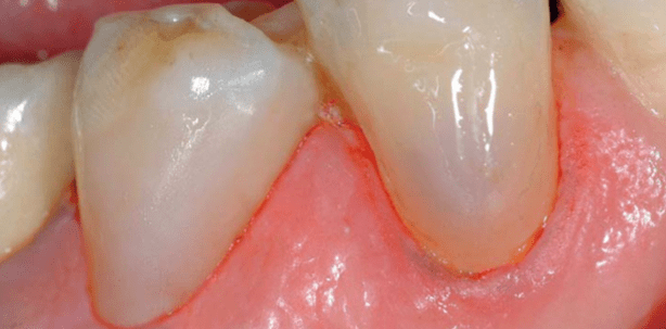 Gerostomatologie in Zeiten demografischen Wandels