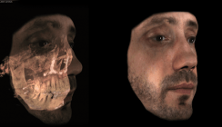 Gesichtsscanner unterstützen Behandlungsplanung