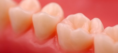 Aktuelle Konzepte zur Prävention von Gingivitis und Parodontitis