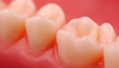 Aktuelle Konzepte zur Prävention von Gingivitis und Parodontitis