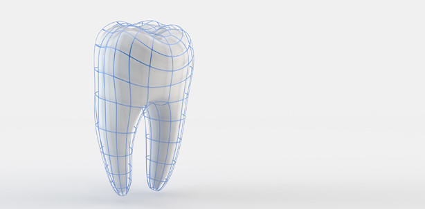 Mit Glasionomermaterialien in die Zukunft