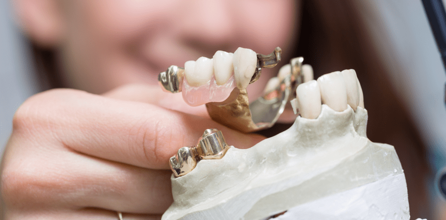 Zahnersatz: Neue moderne Therapie jetzt GKV-Leistung