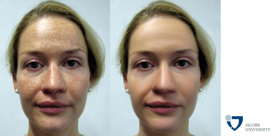 Noch etwas Puder? Glatte Haut macht seriös