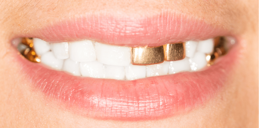 Statussymbol: Weiß ist das neue Gold