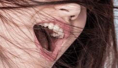 Schöne Haare – schöne Zähne?