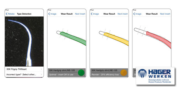 Spitze(n) Sache – Die neue Cavitron Insert App ist da