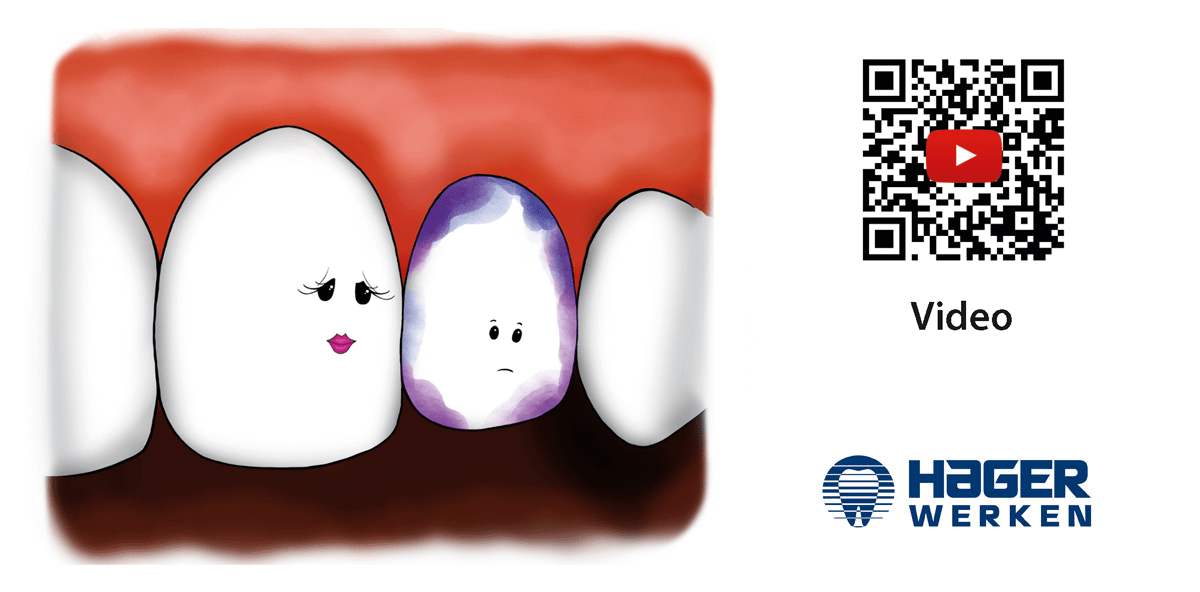 Die Geschichte einer kleinen Färbetablette mit großer Wirkung