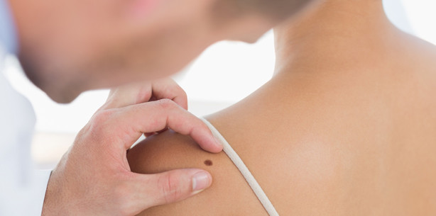 Hautkrebs frühzeitig, schmerzfrei und sicher erkennen