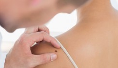 Hautkrebs frühzeitig, schmerzfrei und sicher erkennen