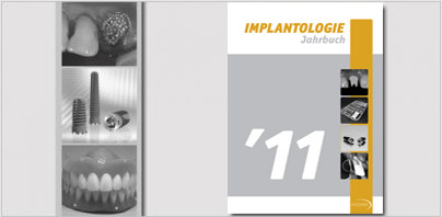 Jahrbuch Implantologie 2011 erschienen