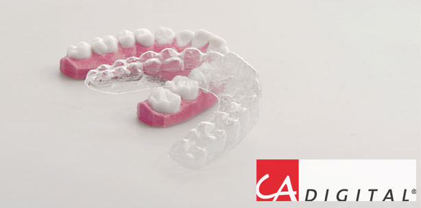 CA-DIGITAL® Die effektive Alignertherapie für Ihr Labor