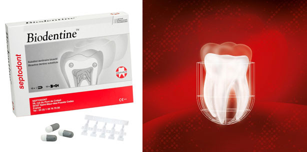 Biodentine™ jetzt auch als App verfügbar