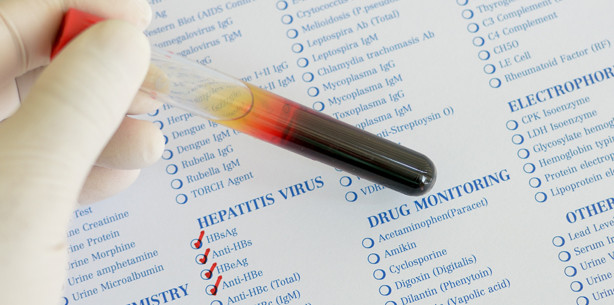 Oralchirurg infizierte Patienten mit Hepatitis C