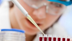 Hepatitis C: Gezielte Behandlung für Patienten mit Neuinfektion