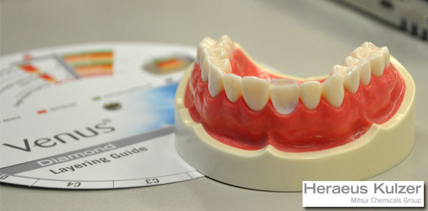 Form vor Farbe: Tipps zur Frontzahn-Restauration
