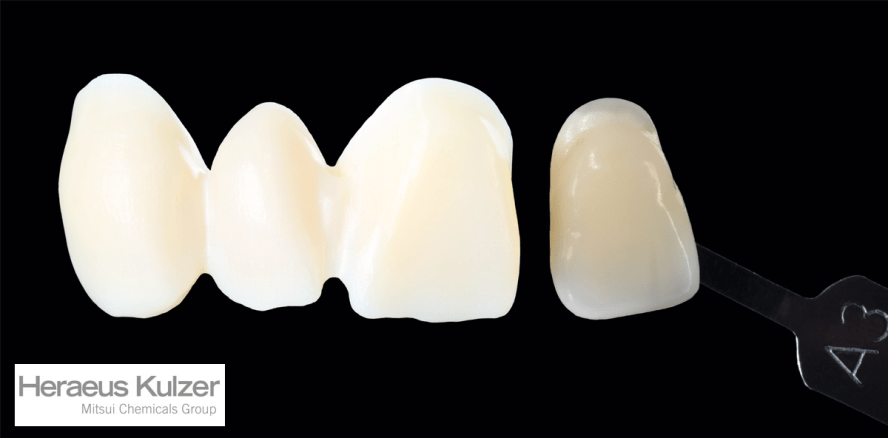 Mehr Massen für individuellere Schichtungen