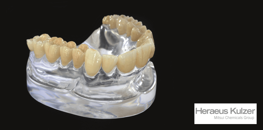 Heraeus Kulzer: Auch digital mehrschichtig denken