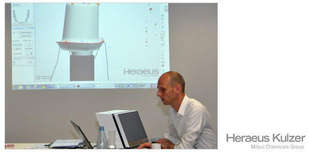 Digitales Design für individuelle Implantatlösungen