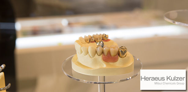 Altgold ist jetzt mehr wert