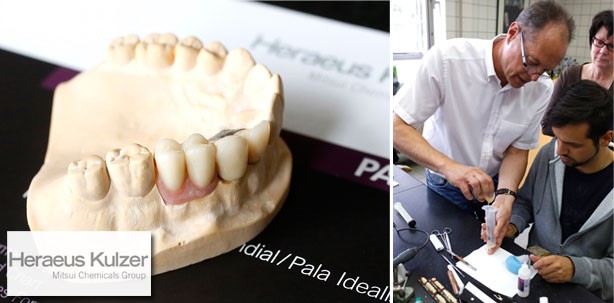 PalaVeneertechnik-Workshop: Gekonnt kombiniert