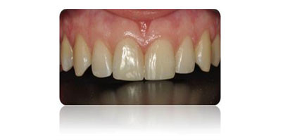 Ästhetik in ihrer schönsten Form