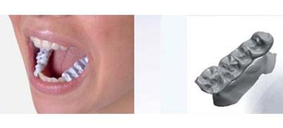 productTeaserImage