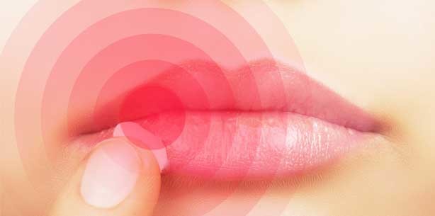 Herpes-Alarm – Was tun bei Lippenbläschen?!