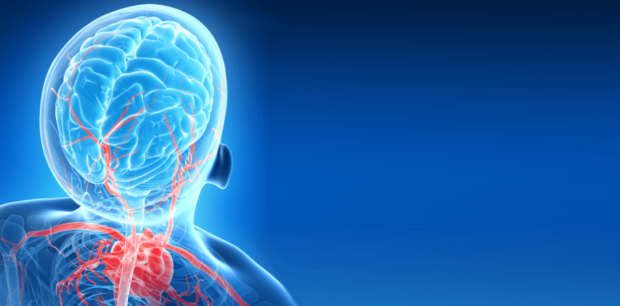 Herzinfarkt? Schlaganfall? – Frag die Zahnpasta!