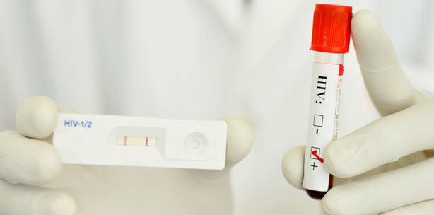 Trotz HIV-Infektion – Zahnarzt behandelte 3.000 Patienten