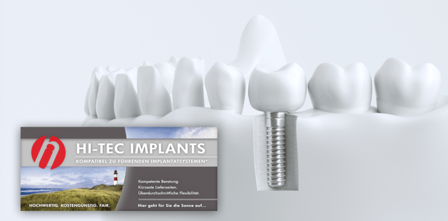 HI-TEC Implants präsentiert deutsche Website