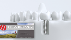 HI-TEC Implants präsentiert deutsche Website