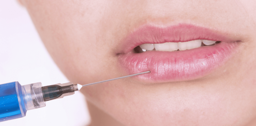 Lippenkorrektur kann Gesichtslähmung lindern