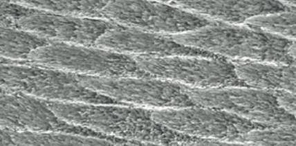 Hydroxylapatit kann Zahnschmelz reparieren