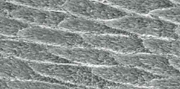Hydroxylapatit kann Zahnschmelz reparieren