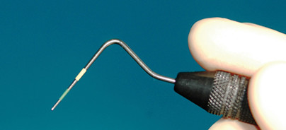 Einfache Diagnostik in der Zahnarztpraxis