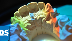 Prothetik & Implantologie auf der IDS 2015