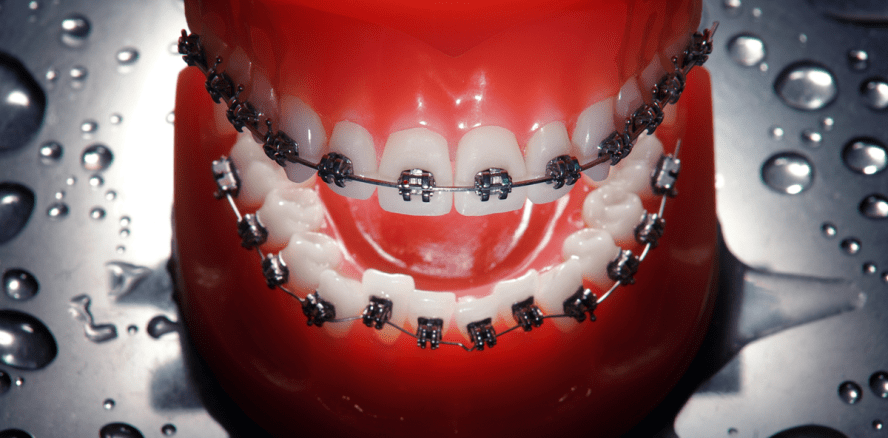 Im Zeichen der Kieferorthopädie