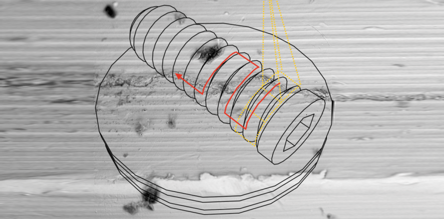 Qualitätsunterschiede von einteiligen dentalen Implantaten im REM