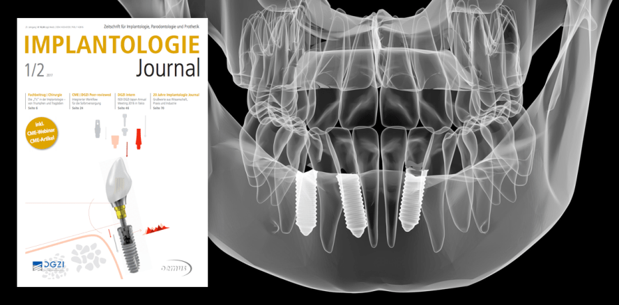 20 Jahre Implantologie Journal: Jubiläumsausgabe ist online