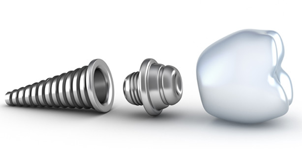 Implant expo® 2013: bereits viele Aussteller angemeldet