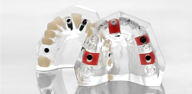 2,5 Mio. Potenzial an Implantatpatienten