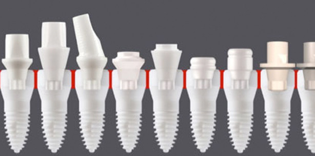 Zweiteilig reversibel verschraubtes Zirkonoxid-Implantat