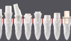 Zweiteilig reversibel verschraubtes Zirkonoxid-Implantat