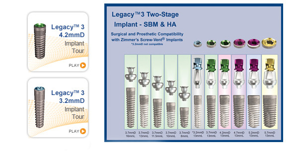 Implant Direct präsentiert LEGACY 3