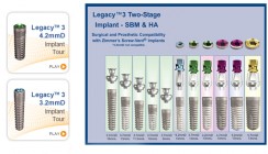 Implant Direct präsentiert LEGACY 3