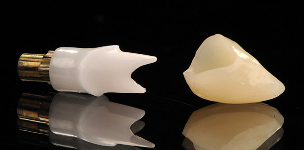 CAD/CAM und Implantologie – eine erfolgreiche Kooperation